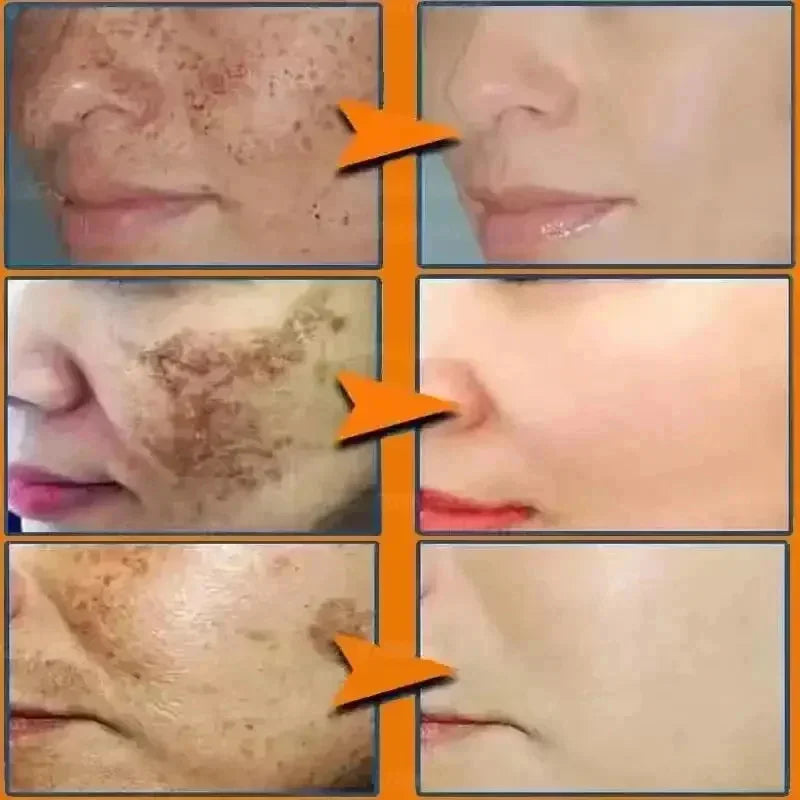 Creme Facial Clareador Anti-Manchas 577
