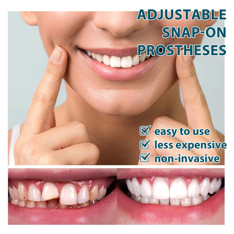 Dentadura Estética Temporária – Sorriso Imediato