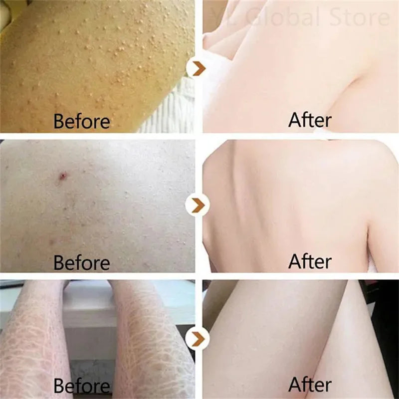 Creme Renovador Corporal – Pele Lisa e Hidratada