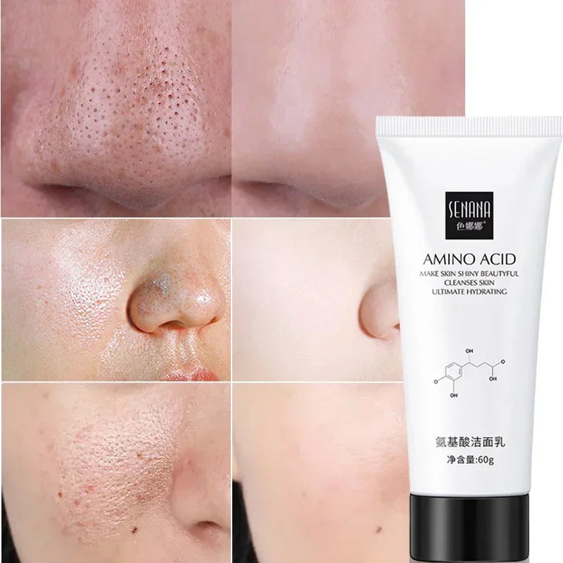 Sabonete Facial Nicotinamida e Aminoácidos
