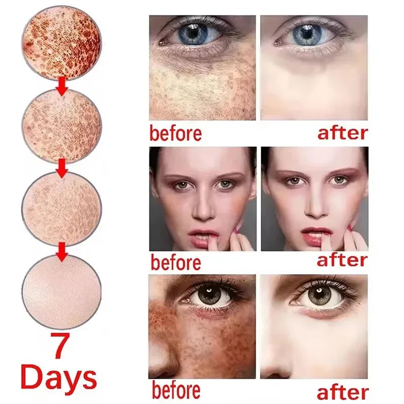 Creme Facial Clareador Anti-Manchas 577