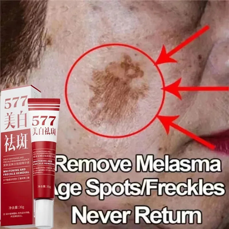 Creme Facial Clareador Anti-Manchas 577
