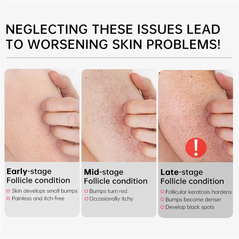 Creme Renovador Corporal – Pele Lisa e Hidratada
