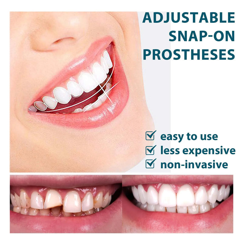Dentadura Estética Temporária – Sorriso Imediato
