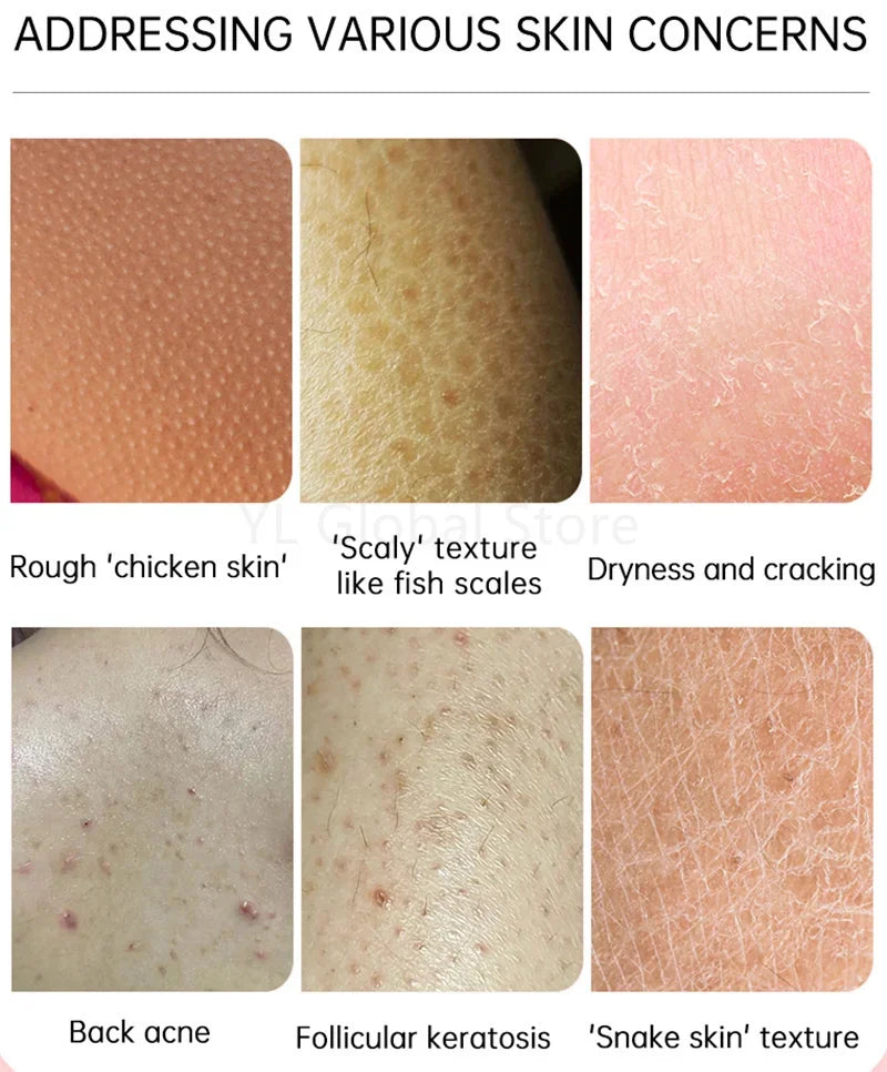 Creme Renovador Corporal – Pele Lisa e Hidratada