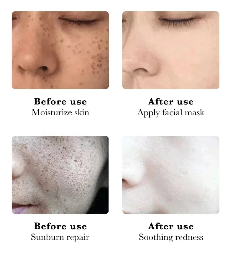 Creme Facial Clareador Anti-Manchas 577