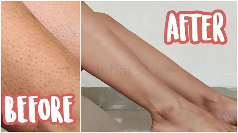 Creme Renovador Corporal – Pele Lisa e Hidratada