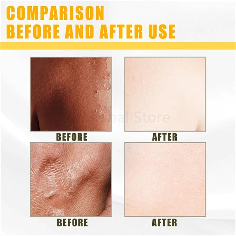 Creme Renovador Corporal – Pele Lisa e Hidratada