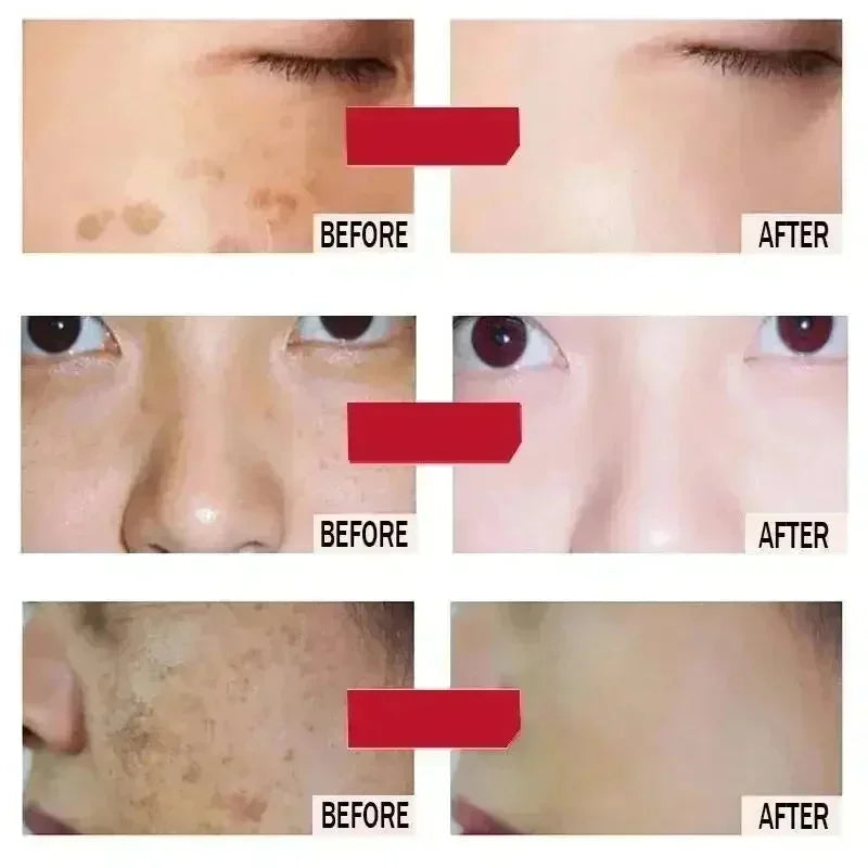 Creme Facial Clareador Anti-Manchas 577