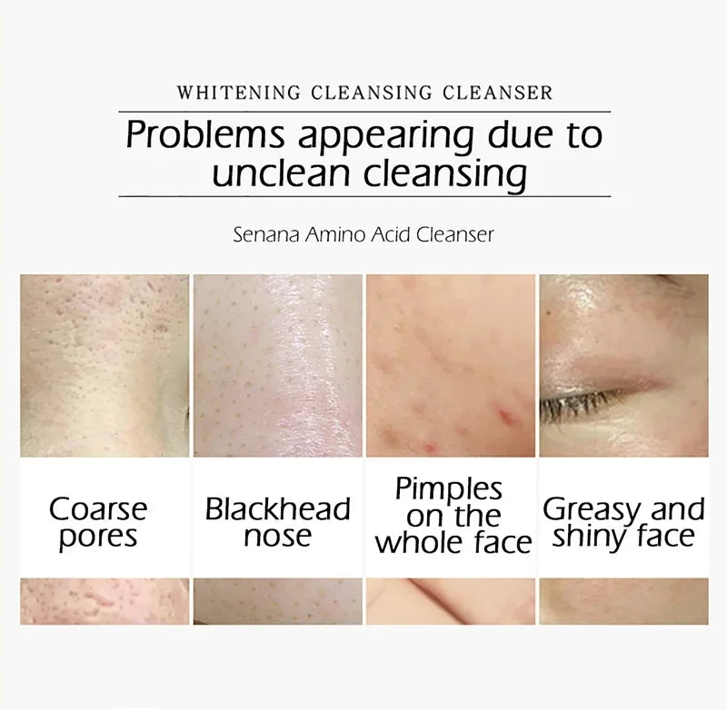Sabonete Facial Nicotinamida e Aminoácidos
